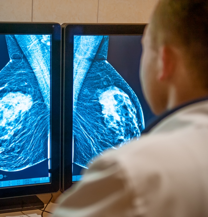 Mammogram